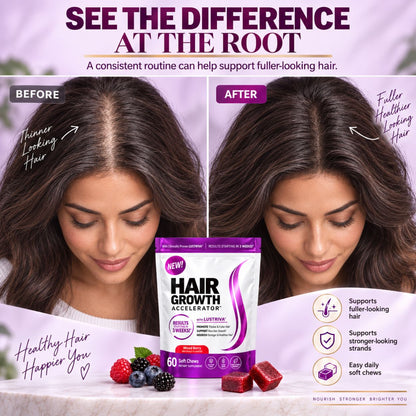 Hair Growth Accelerator with Lustriva® – 60 Gummies