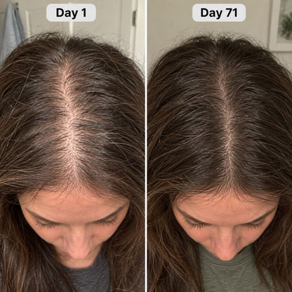 Hair Growth Accelerator with Lustriva® – 60 Gummies