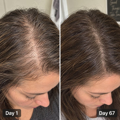 Hair Growth Accelerator with Lustriva® – 60 Gummies